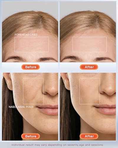 LED Red Light Therapy Mask for Face Skin Glowing,630nm Led Light Therapy Face Mask Anti Wrinkle, Blue Light Therapy Face Mask for Acne,Home use,450 LED Chips,Birthday gift,Plug in