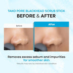 Tako Pore Blackhead Remover Scrub Stick Charcoal & Dead Sea Salt Exfoliator for Blackheads, Whiteheads, Pore Cleansing & Oil Control, 0.8 oz