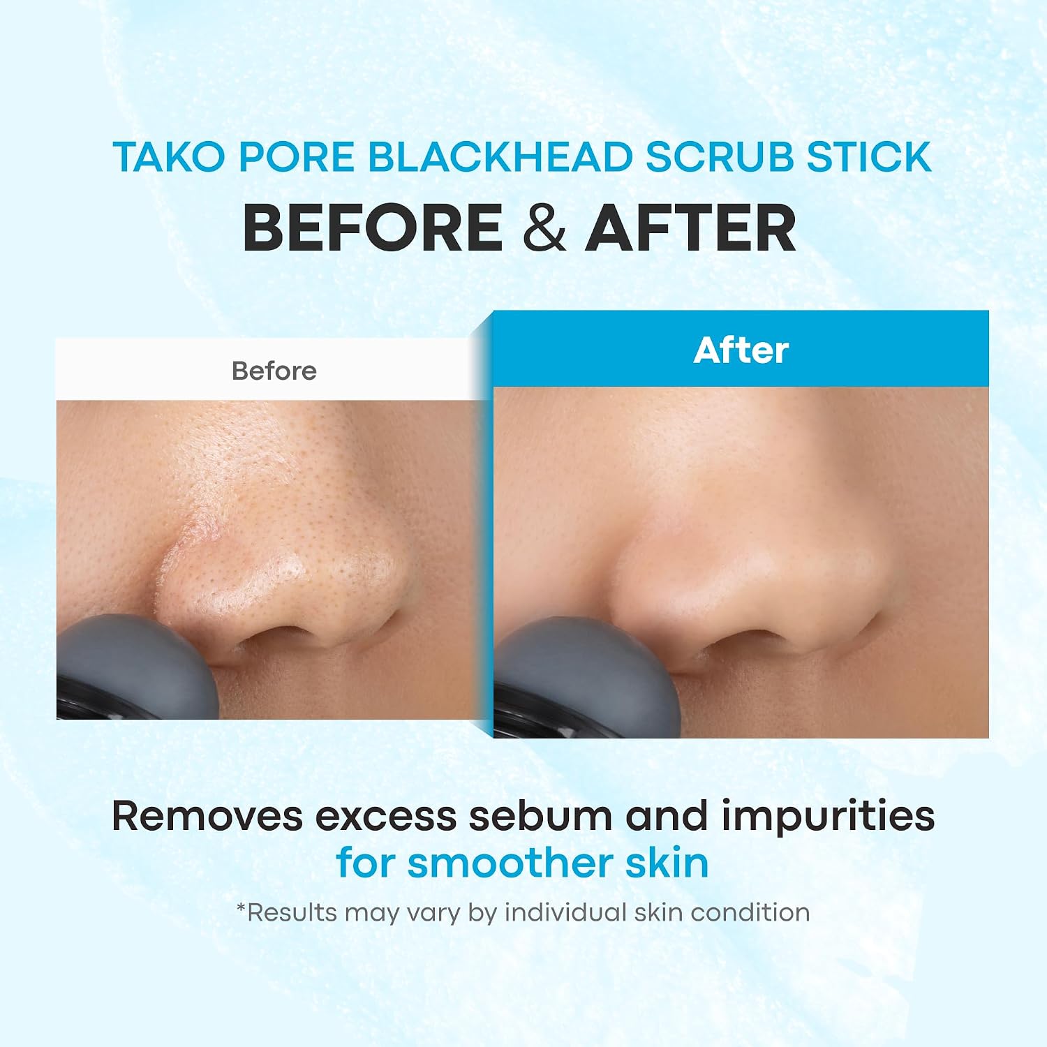 Tako Pore Blackhead Remover Scrub Stick Charcoal & Dead Sea Salt Exfoliator for Blackheads, Whiteheads, Pore Cleansing & Oil Control, 0.8 oz