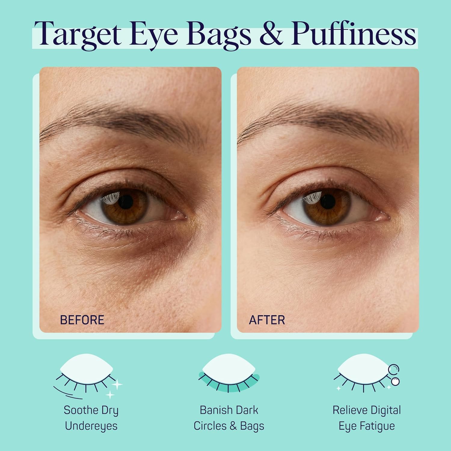 SpaLife Cooling Eye Pads | Spa Gifts & Korean Dark Circles & Puffy Eyes Treatment | Nourishing Eye Pads | Eye Mask for Puffy Eyes Daily Depuffing Eye Patches | 4 Packs of 12